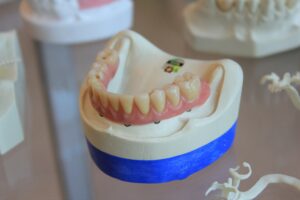 Initial Consultation and 3D Imaging
